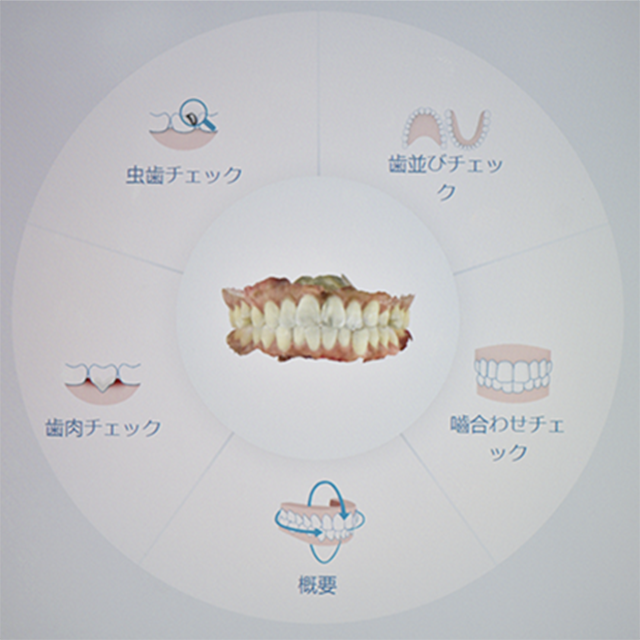 『iTero Element 5Dプラス』の特長