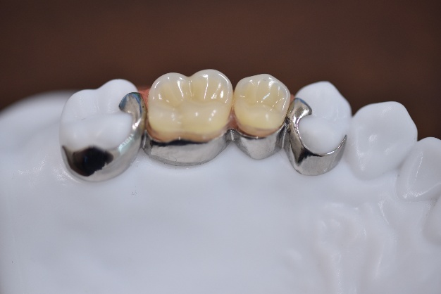 食事や会話が自然に