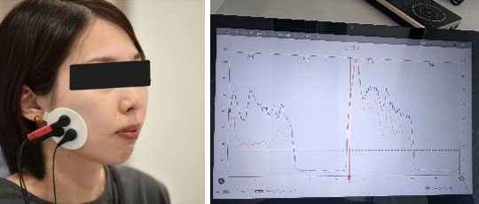 どのように測定する?